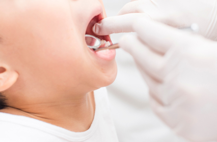 幅広い口腔外科対応と高度な技術