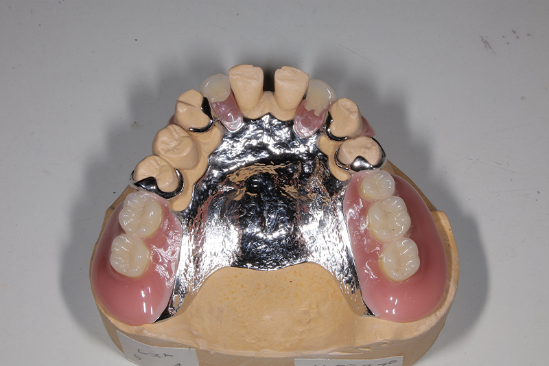 当医院では入れ歯の治療や補修も行っています