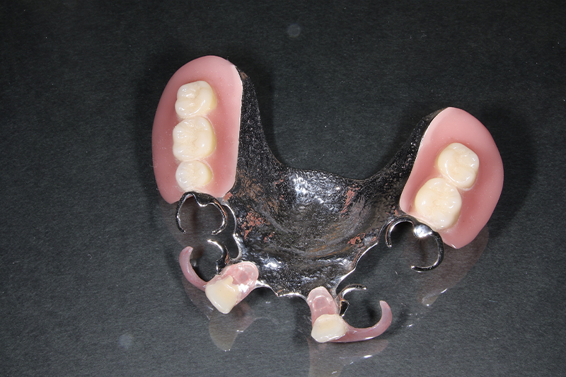 当医院では入れ歯の治療や補修も行っています