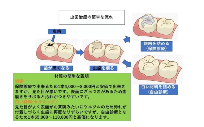 虫歯治療など一般的な全ての歯科治療
