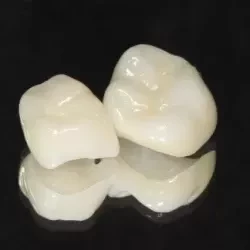 ⑤セラミッククラウン・インレー(e-max)(奥歯)　60,000(税込66,000円)