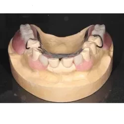 ②スマイルデンチャー両側　150,000円(税込165,000円)